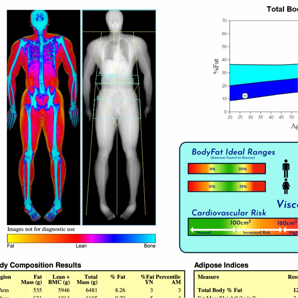The Full Details of a Dexa Scan Report