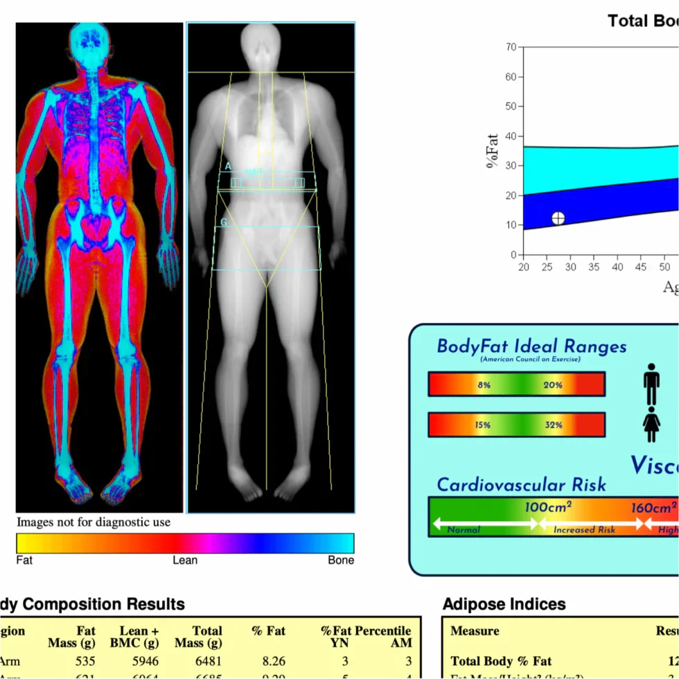 The Full Details of a Dexa Scan Report – DEXA SCAN NEAR ME